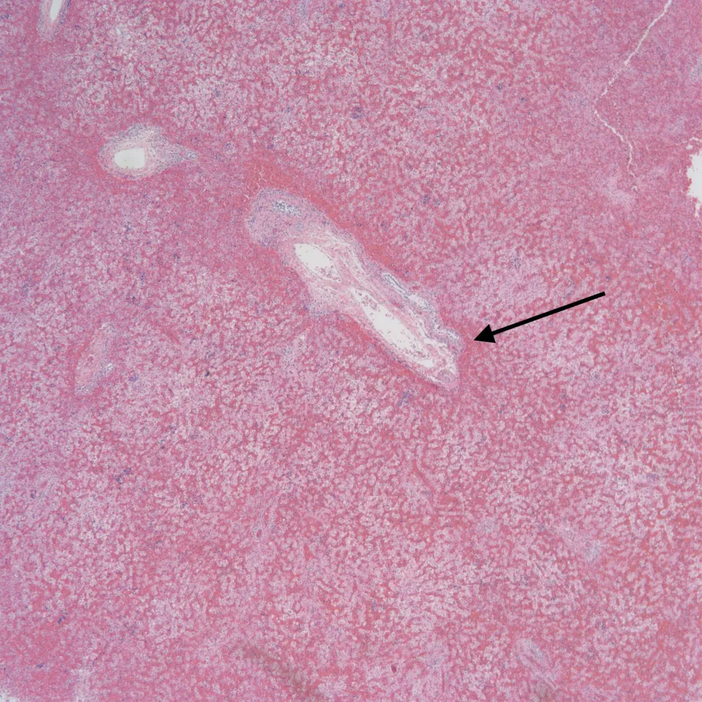 Fetal Autopsy: Liver