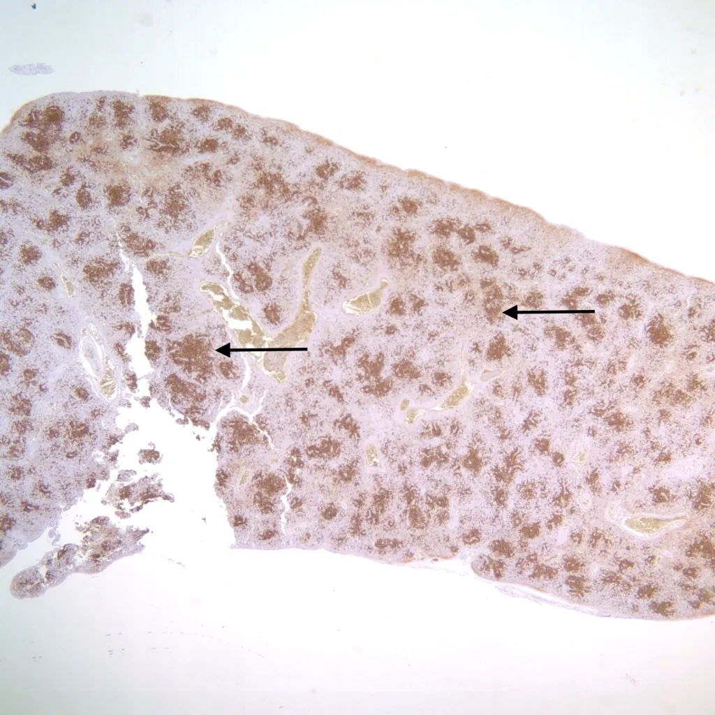 Fetal Autopsy: Spleen